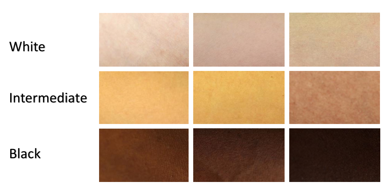 Skin colours